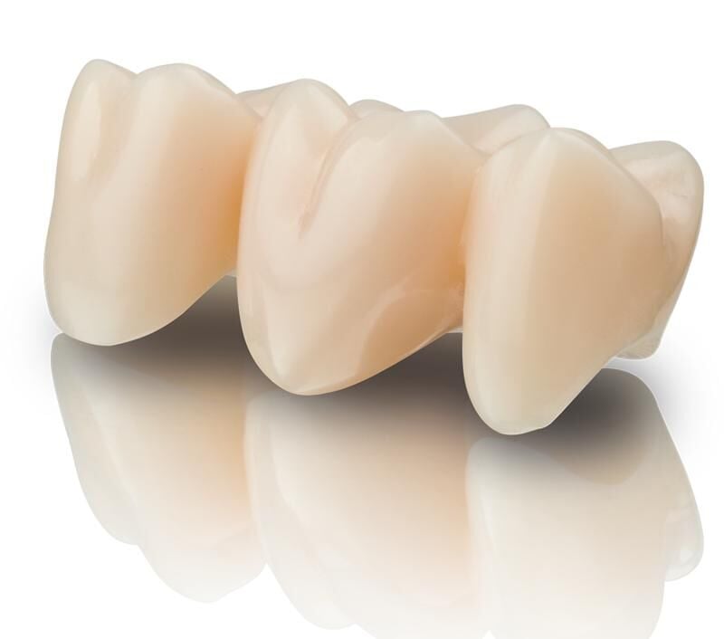 VarseoSmile TriniQ B1, 500g