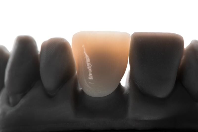 VarseoSmile TriniQ B1, 500g