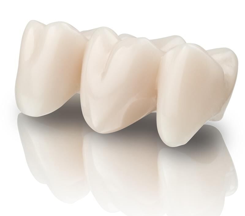 VarseoSmile TriniQ 0M1, 500g