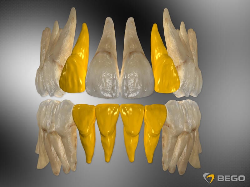 BEGO SEMADOS® IMPLANT RSX3.0 L11.5 TiPure Plus